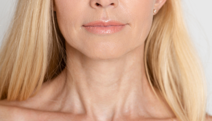 Mature woman neck lift skin tightening