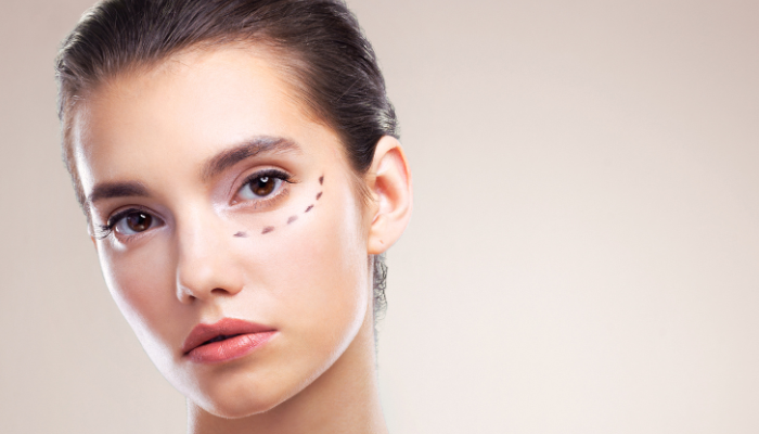 how to get rid of eye bags