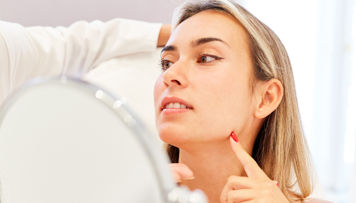 Facelift at 40 vs. Facelift at 60